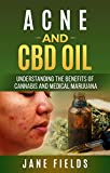 Acne & CBD OIL :: Understanding the Benefits of Cannabis & Medical Marijuana: How to Best Treat Acne, Pimples and Skin issues with CBD Oil. Natural & Organic Skincare (English Edition)
